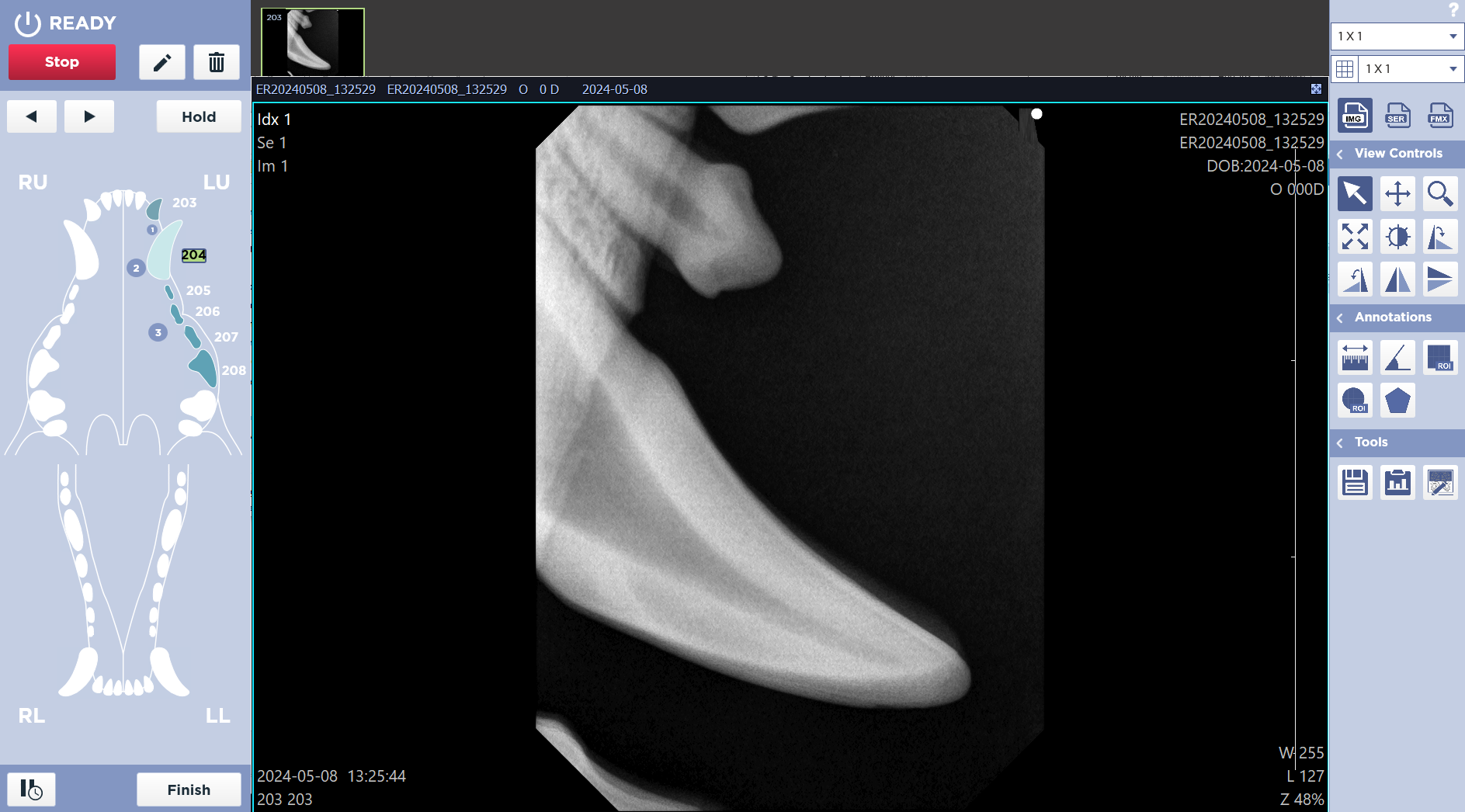 Image Acquired